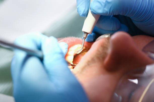 Best Broken or Chipped Tooth Repair in Prescott Valley, AZ
