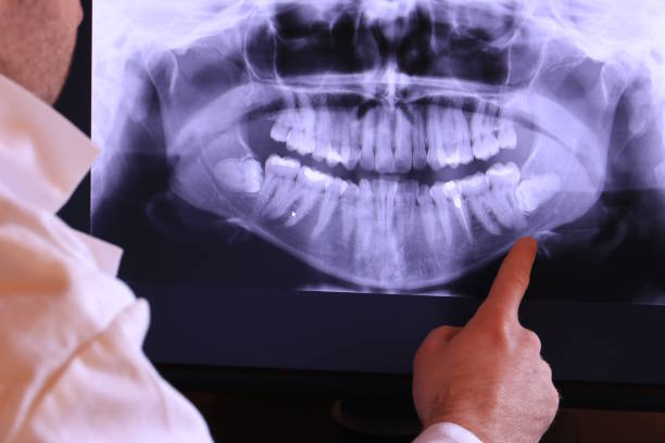 Best Emergency Treatment for Oral Infections in Prescott Valley, AZ